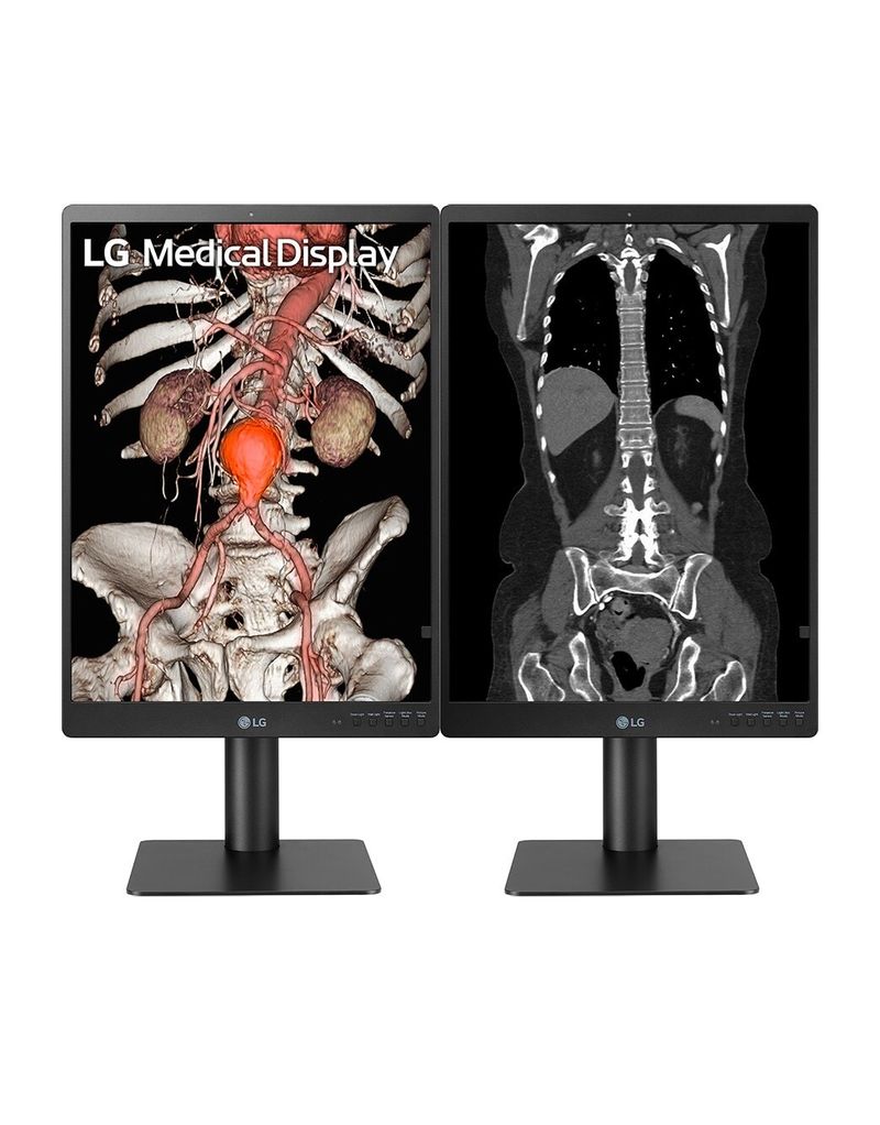 Monitor-LG-21HQ513D-B-21---Scala-di-Grigi-3MP