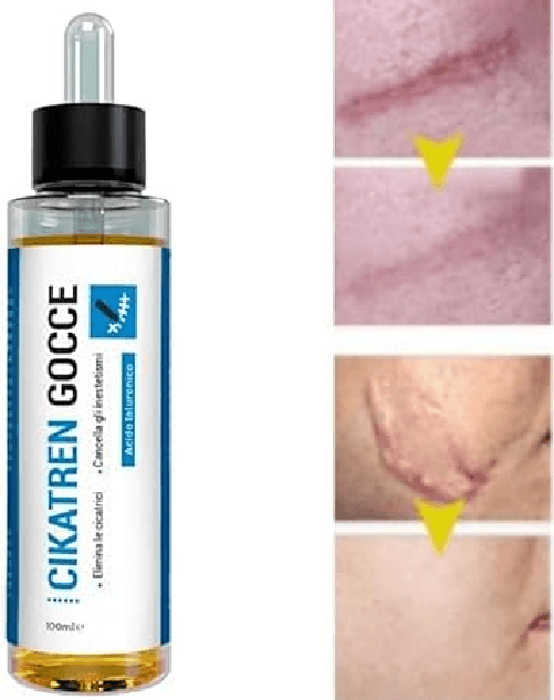 Cikatren---Crema-Rigenerante-per-Cicatrici-Chirurgiche-Ustioni-Naturale-Trattamento-Elasticizzante-pack-2x-100ml-Olio-di-Jojoba---Riduce-le-cicatrici-vecchie-e-nuove-causate-da-interventi-chirurgici