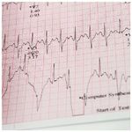 Carta Termica Ecg 210X140 Mm X 215 - Pacco Griglia Arancio conf. 10 pz.