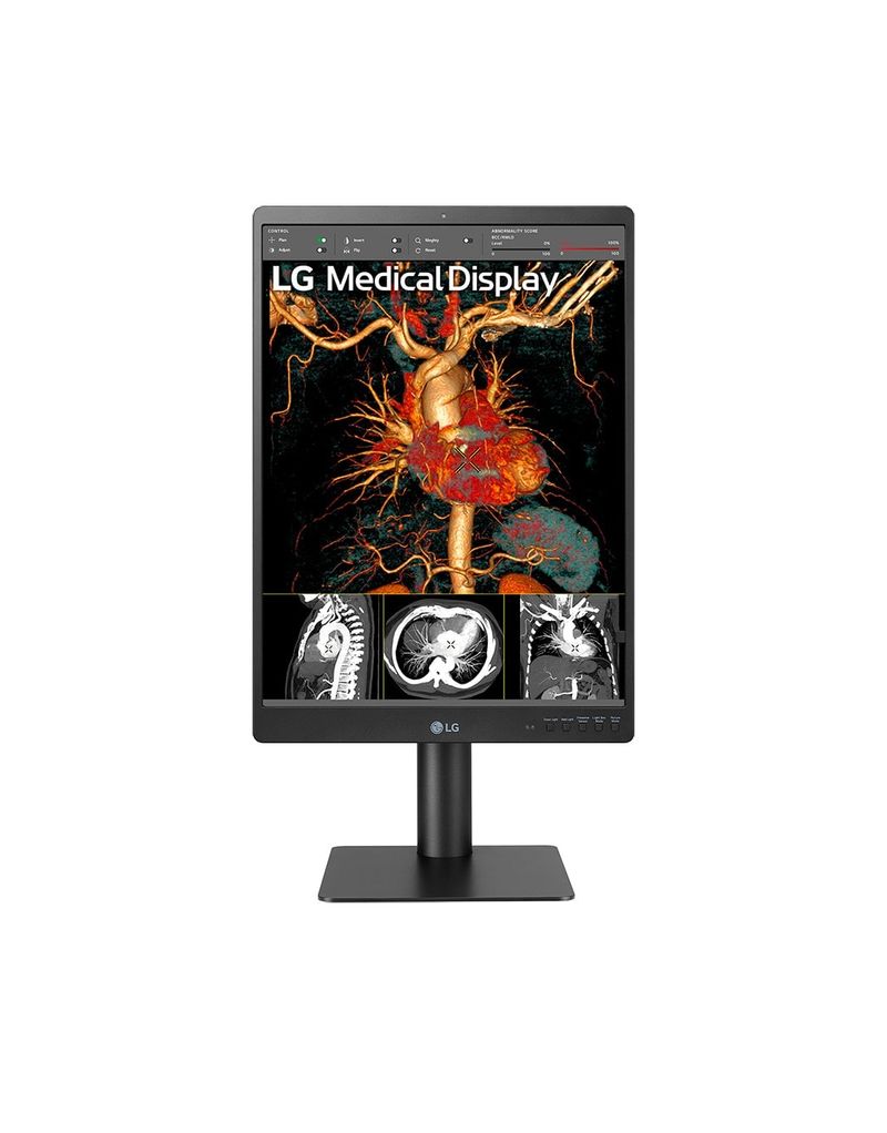 LG-21HQ513D-B-21--Grayscale-3MP-Monitor-PC-541-cm--21.3---1536-x-2048-Pixel-HD-LCD-Nero