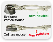 Mouse-verticale4-piccolo-a-destra