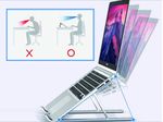 Conceptronic-ERGO-Foldable-Aluminum-Laptop-396-cm--15.6---Supporto-per-computer-portatile-Alluminio